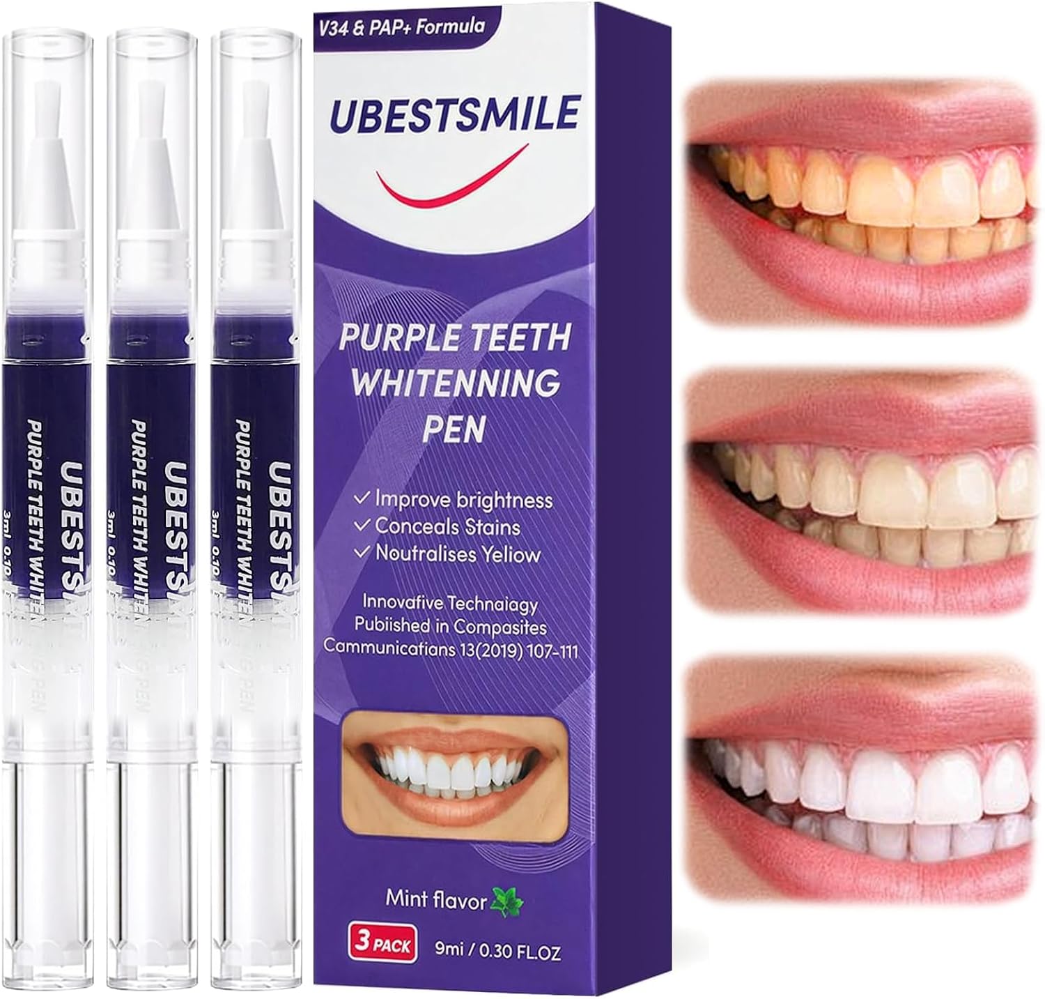 Teeth Whitening Pens - ยูเบสท์สไมล์ V34&PAP+ ฟอร์มูล่า ปากกาฟอกฟันขาวสีม่วง พกพาสะดวกและใช้งานง่าย ชุดปากกาฟอกฟันขาวสำหรับดูแลสุขภาพช่องปาก